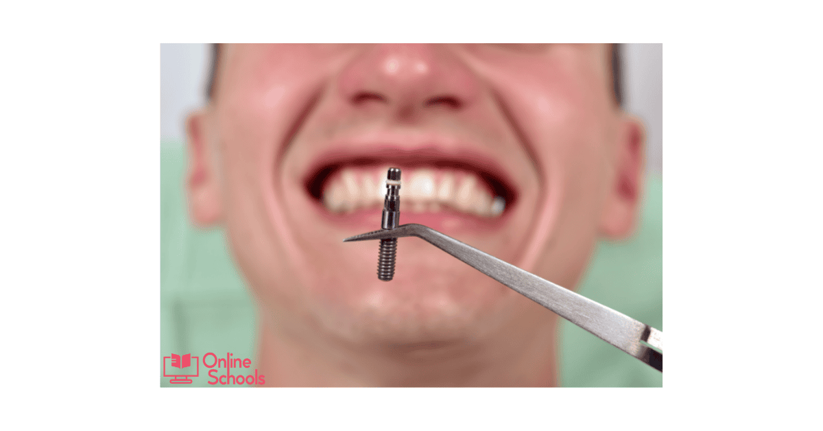 Permanent teeth implants cost